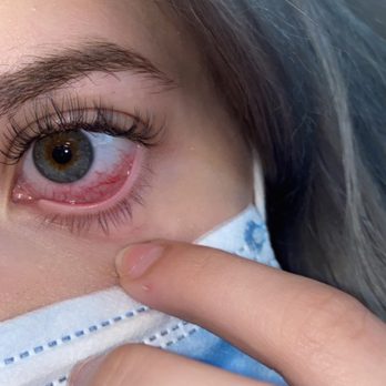 Be Lash'd - Micro cuts , bruising, I wasn't even able to touch my eyeballs that's how much they hurt. - Eyelash Service Near Me - North Arlington, New Jersey