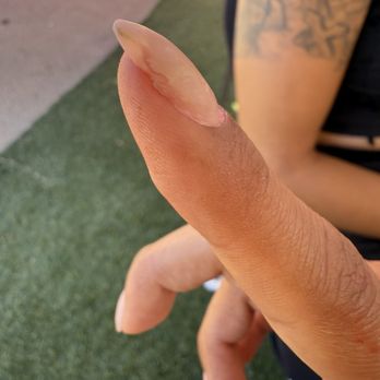 Peacock Nails - 7 hours later the acrylic chipping off - Nail Salons Near Me - Lemon Grove, California Peacock Nails - 7 hours later the acrylic chipping off - Nail Salons Near Me - Lemon Grove, California