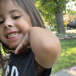 Sparkle Kids Dental Care - And after. She is so happy with her teeth and ready to start TK!