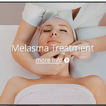 Highstyle Laser Center - Call today to learn more about our Melasma treatment services. - Skin Care Near Me - Boston, Massachusetts Highstyle Laser Center - Call today to learn more about our Melasma treatment services. - Skin Care Near Me - Boston, Massachusetts