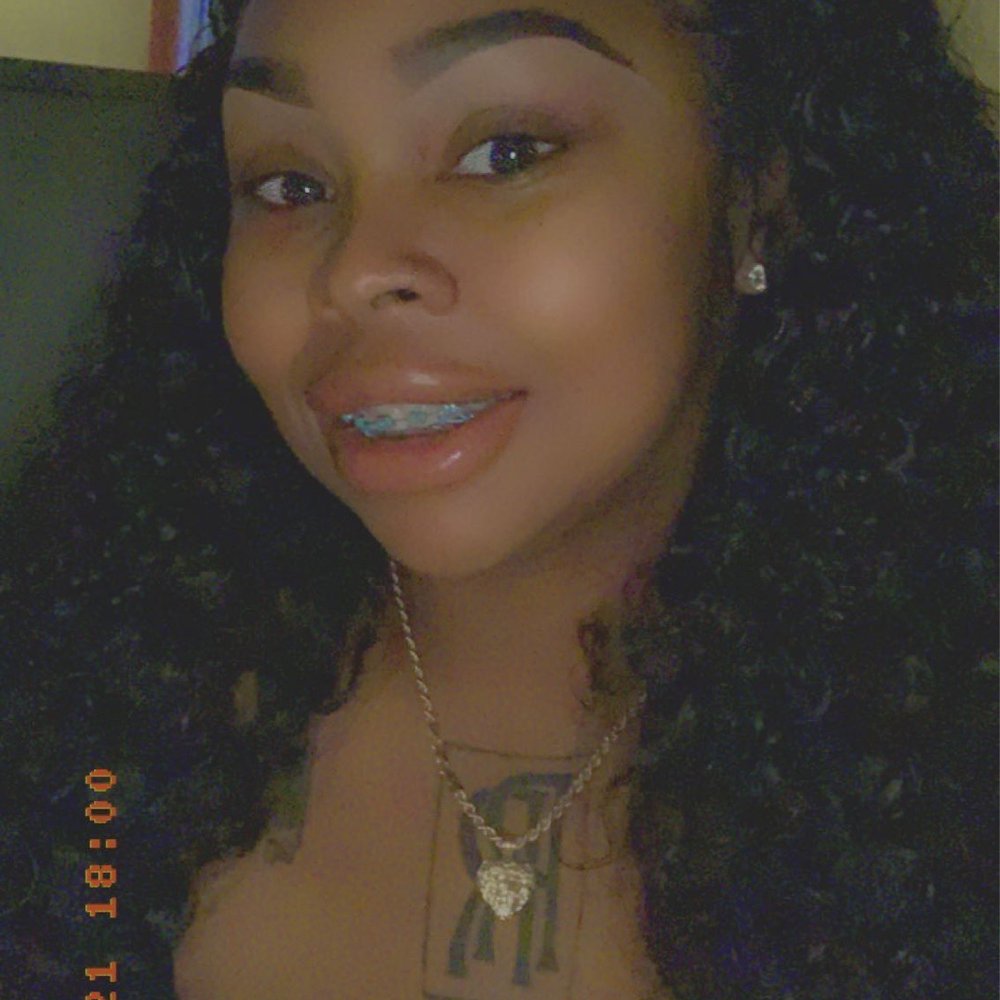 Braces Braces