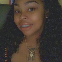 Braces Braces