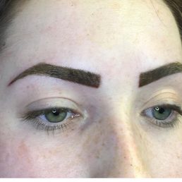 Right after touch up. Results are 30-50% lighter and softer when they heal.