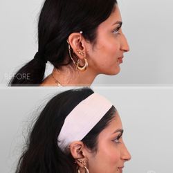 Bay Hills Plastic Surgery
