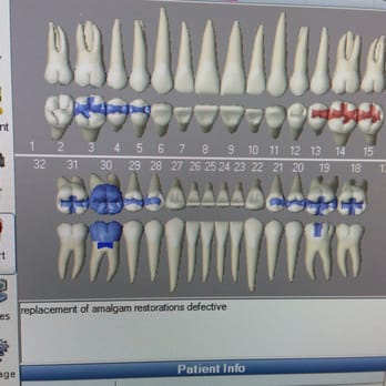 Johnson Family Dental - blue and red were all replaced no more poison - General Dentistry Near Me - Camarillo, California Johnson Family Dental - blue and red were all replaced no more poison - General Dentistry Near Me - Camarillo, California
