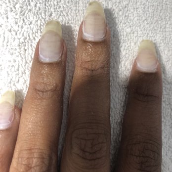 New Nails - Old dirty nails about to be revived by Jenny - Nail Salons Near Me - Davie, Florida