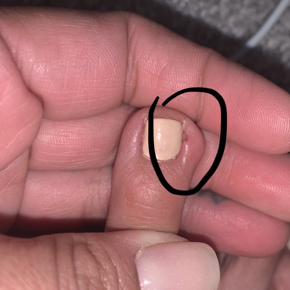 Cut while getting my cuticles trimmed during my pedicure Cut while getting my cuticles trimmed during my pedicure