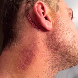 Affiliated Ear Nose & Throat Physicians - Major ear surgery from a rare condition that was found by a competent Dr in downtown Chicago (NOT Dr. Kim)