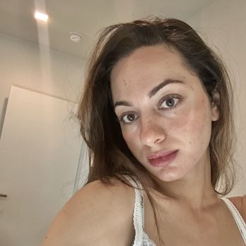 Skin By Dali - Selfie - Medical Spas Near Me - Hermosa Beach, California