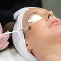 Photoderma