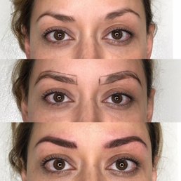 Before and Afters