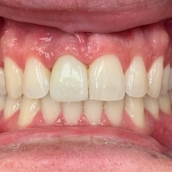 Ross H Dixon, DDS - All better! - General Dentistry Near Me - San Diego, California Ross H Dixon, DDS - All better! - General Dentistry Near Me - San Diego, California