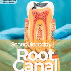 Dental Pointe - #dentalpointe #dentist #rootcanal