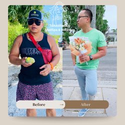 Td Aesthetics - slim shot before and after