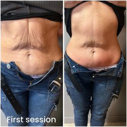 Foxy Brows Ink - Achieve your desired silhouette with Foxy Brows Ink's non-invasive body contouring services...