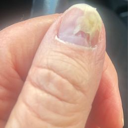 This is 1/1/23, over a month since the appointment. see how she cut my nail (it is not attached to the other parts of my nail)