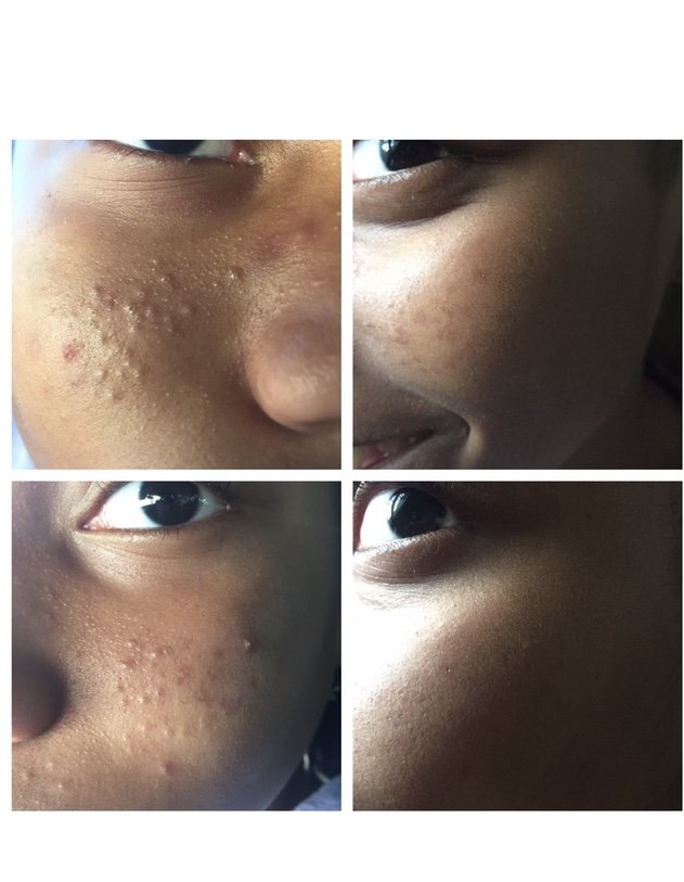 Restoration Beauty Spa Logo