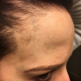 Salon Bella Luca - Black hair dye left all over my face - Hair Salons Near Me - Mentor, Ohio