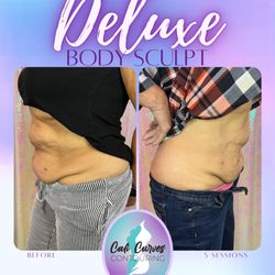 Cali Curves Contouring