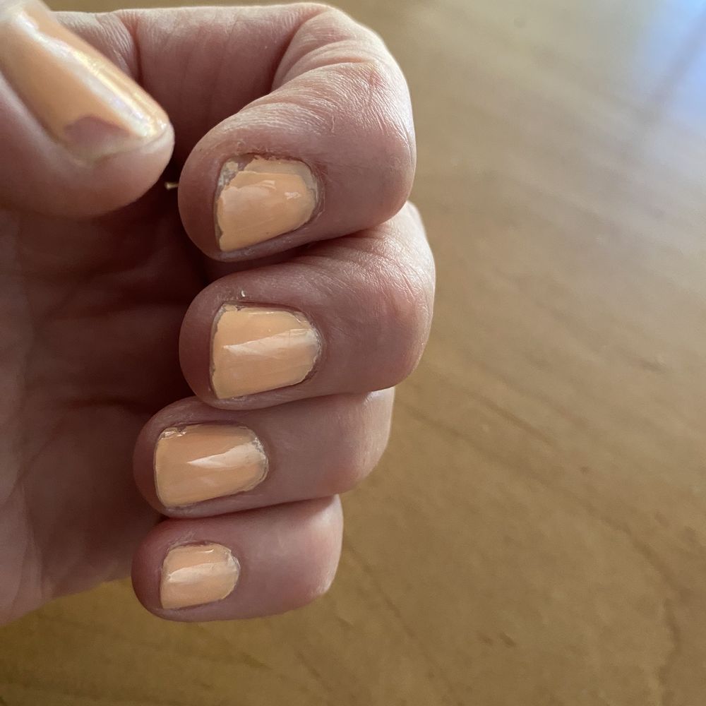 Peeling thumb Peeling thumb