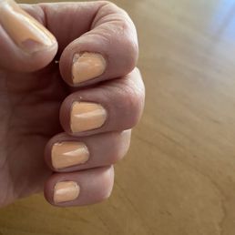 Peeling thumb