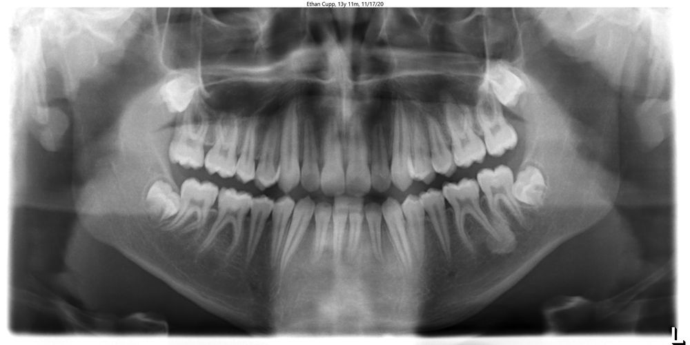 GARN & MASON ORTHODONTICS Updated October 2024 20774 E Walnut Rd