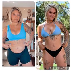 The Bassin Center for Plastic Surgery - Before and three months postop!