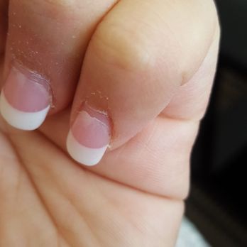 Nails Now - Nails partly peel off on the sides and bottom - Nail Salons Near Me - Sunnyvale, California Nails Now - Nails partly peel off on the sides and bottom - Nail Salons Near Me - Sunnyvale, California