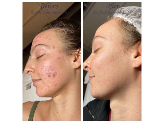 Reflecting Your Beauty