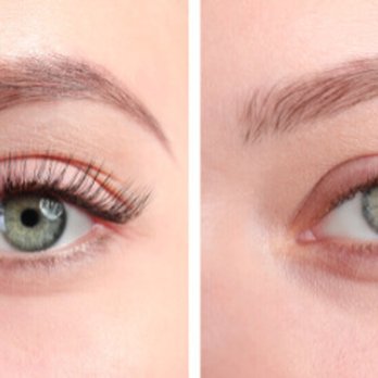 PRODERMIS Kosmetik-Praxis - Wimpernlifting - Skin Care Near Me - Karlsruhe, BW PRODERMIS Kosmetik-Praxis - Wimpernlifting - Skin Care Near Me - Karlsruhe, BW