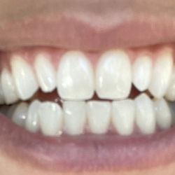 Nick Addario, DDS - Before smile treatment