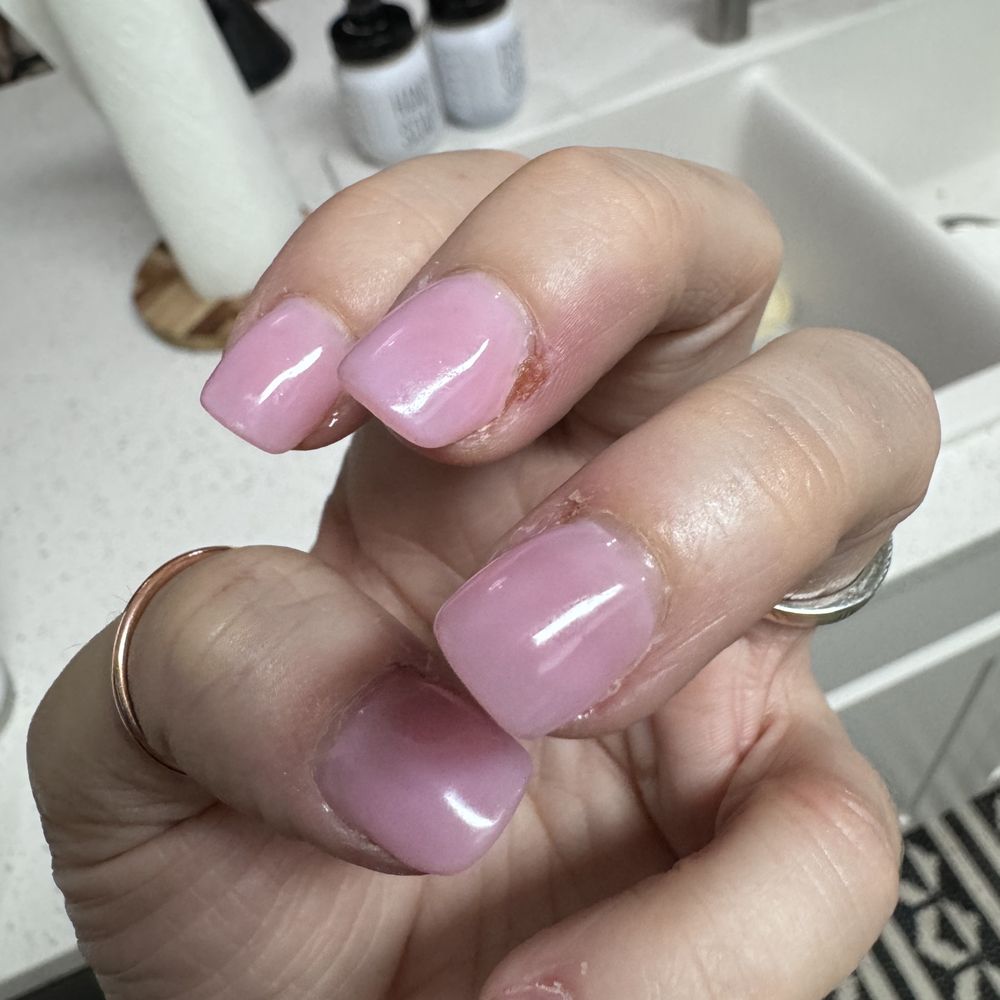 Glitz Nail & Lashes - Cut cuticles, feels and looks infected. - Nail Salons Near Me - Meridian, Idaho Glitz Nail & Lashes - Cut cuticles, feels and looks infected. - Nail Salons Near Me - Meridian, Idaho