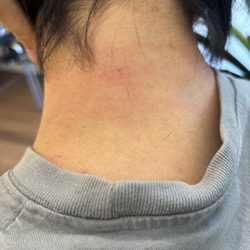 Julian Hair Studio - Rash from haircut