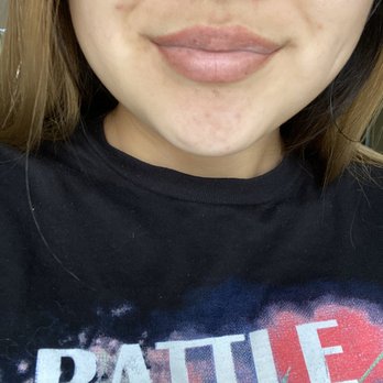 Kissd By Kim - Day 5 - Permanent Makeup Near Me - Orange, California Kissd By Kim - Day 5 - Permanent Makeup Near Me - Orange, California