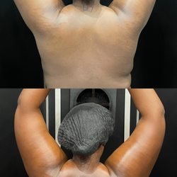OATS Tanning - Before and after on deep dark skin tone; used golden solution