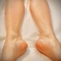 Buckeye Acupuncture