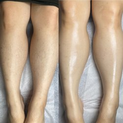 Aloha Beauty Boutique - Before & After Lower Leg Sugaring