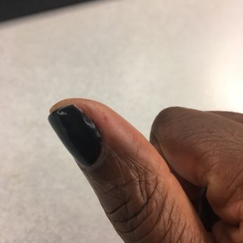 Nailology - Next day, painful cut skin - Nail Salons Near Me - Houston, Texas