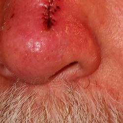 Bend Dermatology Clinic