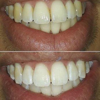 Luis Sanchez, DMD - Kor whitening - Cosmetic Dentists Near Me - Miami, Florida