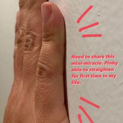 Kevin Minney - Shows side view of my hand against a wall for reference... with my pinky straightened! Never been able to do this!