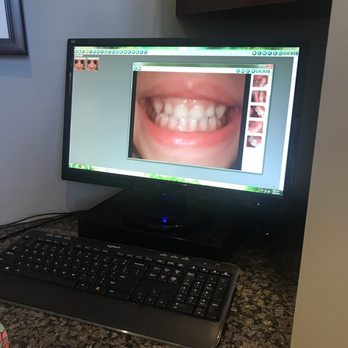 Michael Eggnatz, DDS - Teeth pictures before cleaning! - General Dentistry Near Me - Weston, Florida