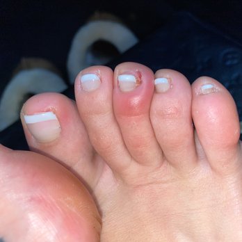 Chic Nails & Spa - Thanks for the infection! I had a call off of work and they wouldn't even give me a refund. - Nail Salons Near Me - San Dimas, California Chic Nails & Spa - Thanks for the infection! I had a call off of work and they wouldn't even give me a refund. - Nail Salons Near Me - San Dimas, California