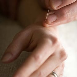 Russell Family Acupuncture - Acupuncture stimulates the body's innate healing response.