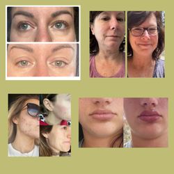 Nutritionally Yours - 1.Eye improvements,
2. looking younger
3. acne gone
4. Soft, plump lips
