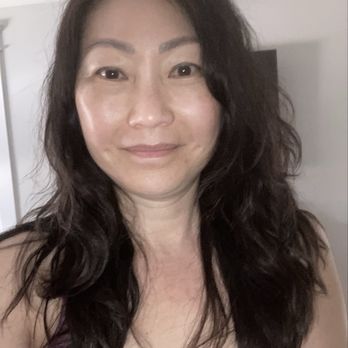 Wenjing Liu, MD - 1 yr post op photo - Cosmetic Surgeons Near Me - Newport Beach, California Wenjing Liu, MD - 1 yr post op photo - Cosmetic Surgeons Near Me - Newport Beach, California