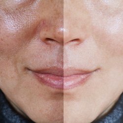 Emerge SkinSpa - Emerge SkinSpa Facials, Dermaplaning, and Peels...Oh my!
