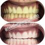 Photo of Change Your Smile