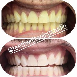 Change Your Smile