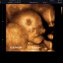 Photo of Tiny Miracles 3D/4D Prenatal Imaging